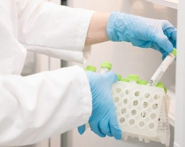 Scientist with gloved hands looking at a Down syndrome biological sample in a tube