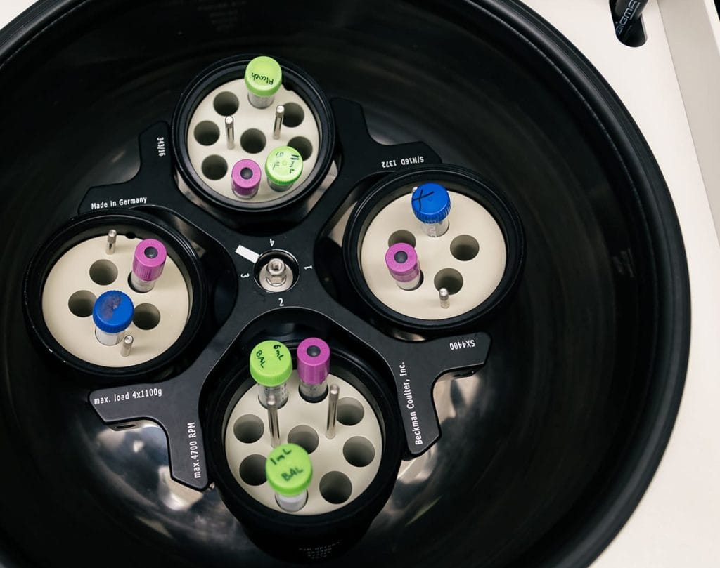 Down syndrome biological samples in a centrifuge