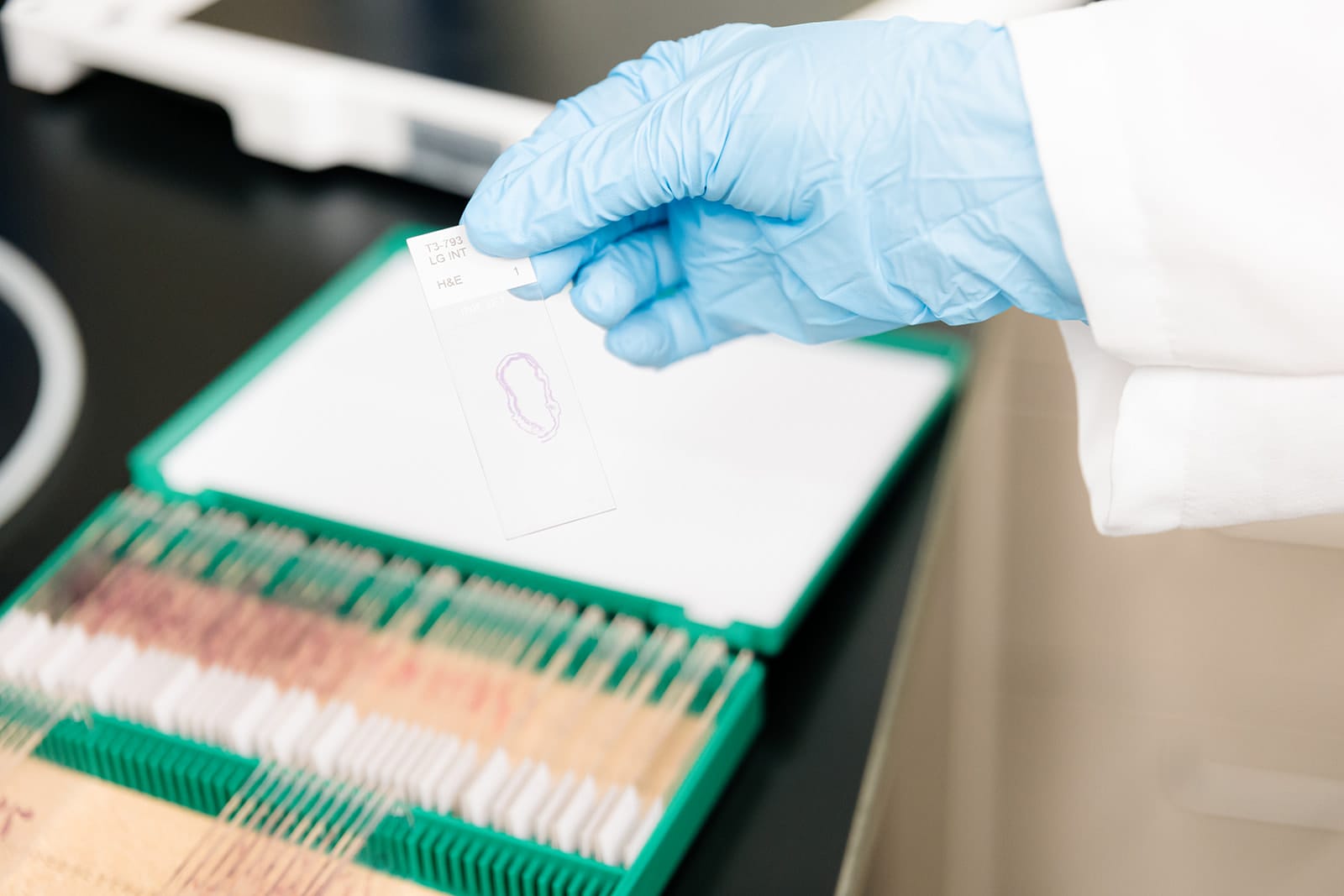 Gloved hand holding a Down syndrome biospecimen on a slide